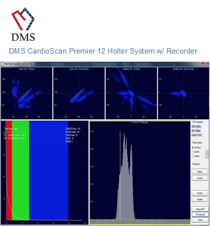 DMS Recorder