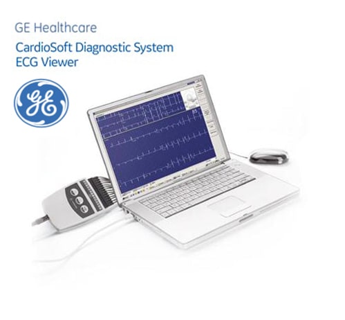 ECG viewer 2