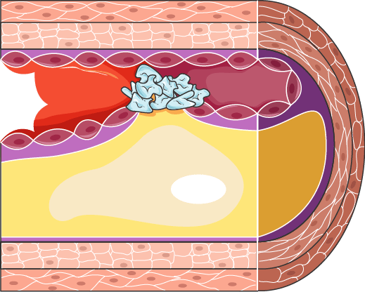 Xolisterini 5