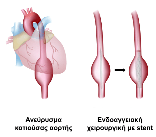 Eksetaseis epembaseis 2 2