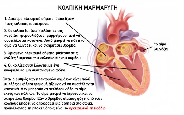 Kolpiki margarigi 1